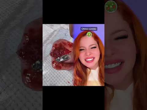 #pov Puedes ver la última cosa que comieron #fypシ #parati