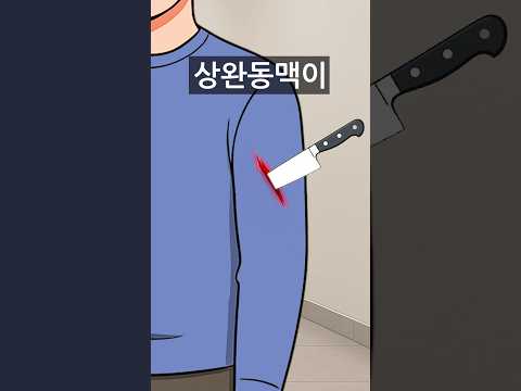 칼에 '팔' 찔렸을 때 살아남는 방법(반대로 하면 끝입니다ㄷㄷ)