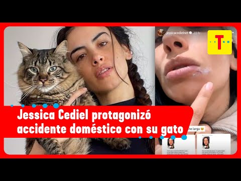 Jessica Cediel terminó en urgencias tras rasguño de su gato | Tropicana