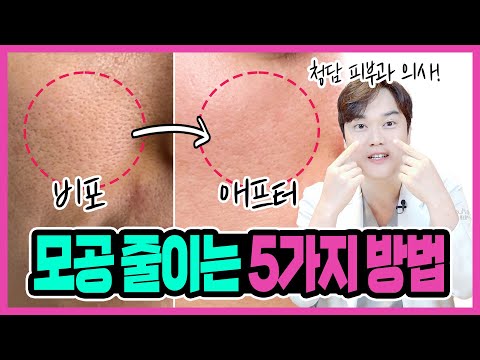 현직 의사가 추천하는 모공 줄이는 5가지 방법! TOP5 "이거만 하시면 피부가 깐달걀처럼 매끈해져요!"