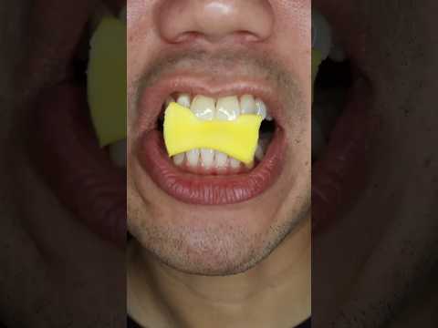 Chewing Gum খাবার আগে সাবধান 🧐।।
