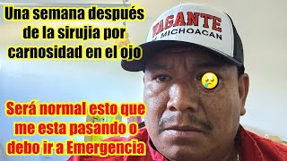 Me aterrorizo ver mi ojo hoy y estoy triste 😥 esta completamente yeno de s@ngr3 por dentro 
