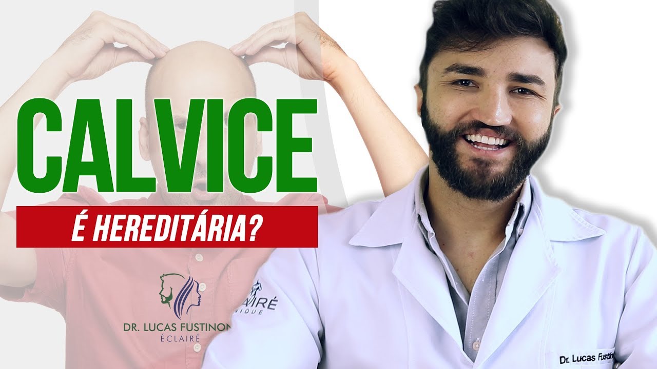 Calvice HEREDIT RIA Ser Que Vou Ficar Careca Dr Lucas Fustinoni