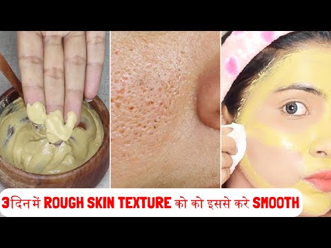 सिर्फ 3 Use-Large Open Pores Will disappear from Your skin forever- Rough Skin Texture करे को Smooth