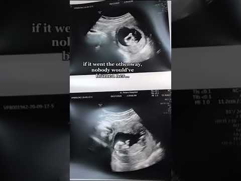 WE MADE THE RIGHT CHOICE #shorts #youtubeshorts #pregnancy #baby #teenmom #storytime #viral