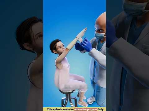 How Does Plaster Work For A Broken Bone 😲😨 || #shorts #bonehealing #bonefracture