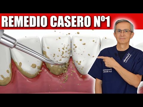 Nº1 REMEDIO CASERO para ELIMINAR la PLACA, el SARRO y PREVENIR la CARIES