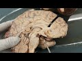 Brain Structures and Their Functions