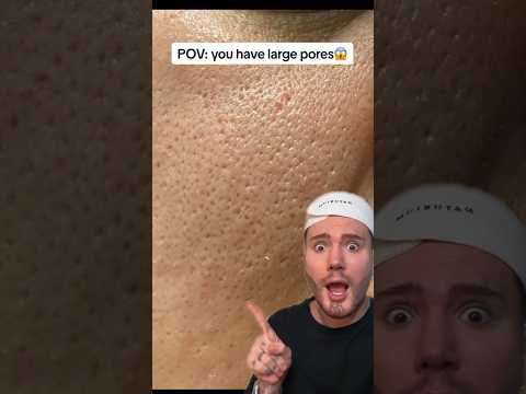 HOW TO GET RID OF LARGE PORES!😱 (follow for more!💗) #acne #skincareroutine #skincare #skin #beauty
