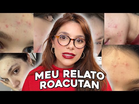MINHA EXPERIÊNCIA TOMANDO O ROACUTAN