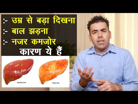 उम्र से बड़ा दिखना, बाल झड़ना, नजर कमजोर, कारण ये हैं || Technical Farming ||
