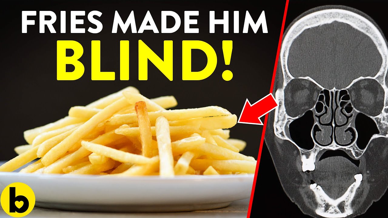Eating French Fries leads to Blindness for this Teen Boy