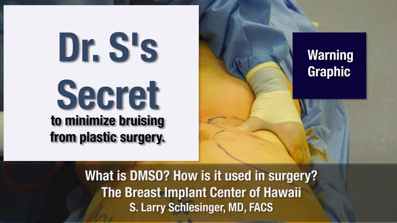 Dr. Schlesinger's Secret to Less Bruising from Plastic Surgery - Breast Implant Center of Hawaii