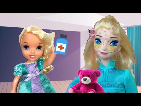 Elsa is all SPOTTY ! What's wrong with Mommy ? Elsia and Annia New Episodes - Barbie Dolls