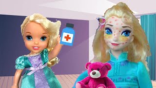 Elsa is all SPOTTY ! What's wrong with Mommy ? Elsia and Annia New Episodes - Barbie Dolls