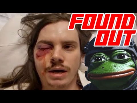 No Kings "Protestor" Gets Rubber Bullet to Eye