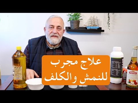 مجربة قوية للقضاء على النمش والكلف وتوحيد لون البشرة