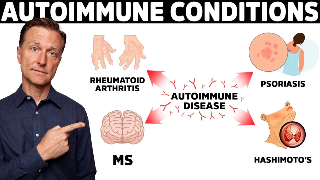 7 Surprising Causes of Autoimmune Diseases They Never Told You About￼