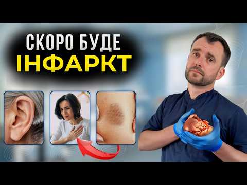 ПЕРШІ ОЗНАКИ ІНФАРКТУ! Ранні симптоми, які ви не помічаєте