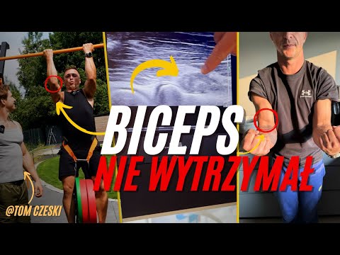 (prawie) ZERWAŁEM BICEPS. Co teraz? Jak to naprawić?