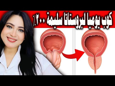كوب يوميًا يقلص حجم البروستاتا المتضخمة 100 % .. تخلص من ألم البروستاتا و احتباس وتقطيع البول