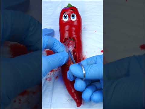 Pepper needs surgical operation  Birth of a baby #shorts