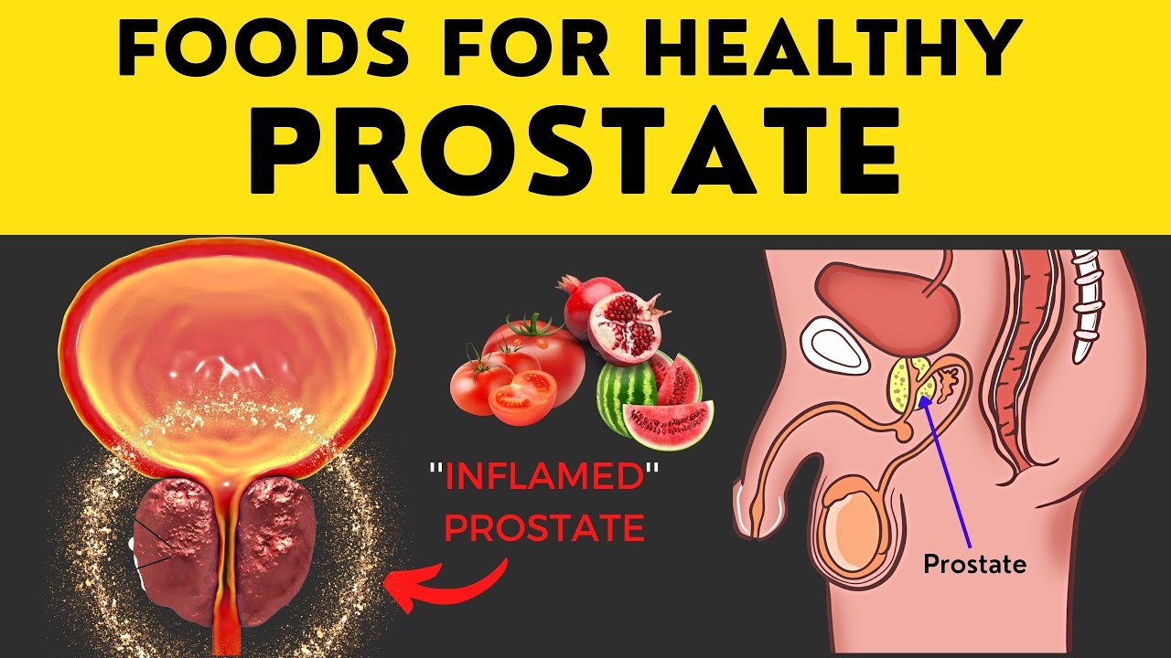 Best FOODS for Healthy PROSTATE 