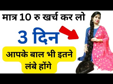 डॉक्टर भी हैरान है! बस 3 Wash में बालों की लंबाई को 10 गुना बढ़ता देखकर | Powerful Hair Oil