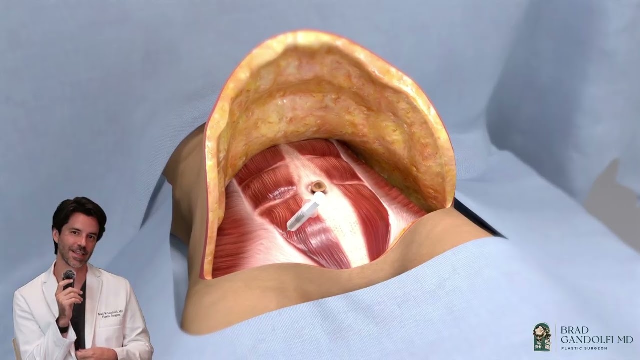 Medical illustration of facial anatomy and procedures.