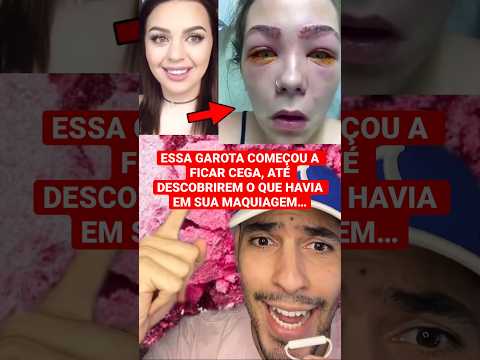 ESSA GAROTA COMEÇOU A FICAR CEGA APÓS USAR MAQUIAGEM