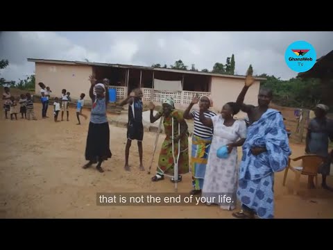 YouTube video thumbnail: Leprosy Explained: What it Is, How it’s Treated, and Why the Stigma Must End