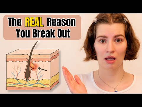 The Same Skin Reaction Behind Every Acne Breakout – Explained