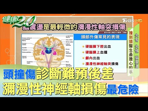 診斷難預後差 頭撞傷以瀰漫性神經軸損傷最危險 健康2.0