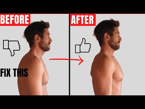 How to Fix Rounded Shoulders