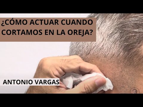 CÓMO PROCEDER CUANDO CORTAMOS LA OREJA AL CLIENTE-ANTONIO VARGAS