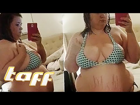 Abnehmen EXTREM! 68 Kilo abgenommen | taff | ProSieben