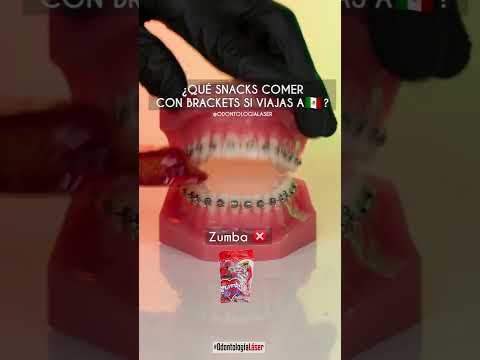 ¿Qué comer con brackets en 🇲🇽? - Odontología Láser #Shorts