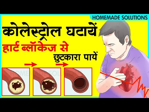 कोलेस्ट्रॉल को ख़त्म करें और  हार्ट ब्लॉकेज से छुटकारा पाएं | Remove cholesterol & Cleanse Arteries