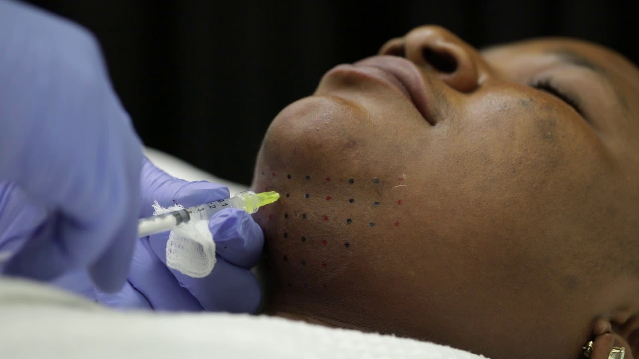 Skin treatment with injection on chin area.