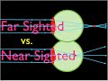 Understanding Farsightedness and Nearsightedness