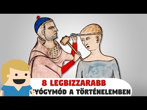 8 legbizarrabb orvosi tévhit a történelemből!