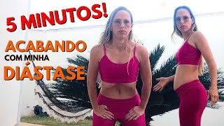 Como Faço Para Fechar Diástase e Modelar Cintura Depois Do Parto