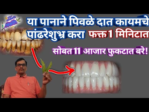 एकदाच हे पान असे चावा 1 मिनिटात पिवळे दात मोत्यासारखे पांढरेशुभ्र होतील,teeth clean in minute