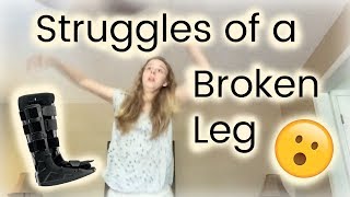 Struggles of a Broken Leg