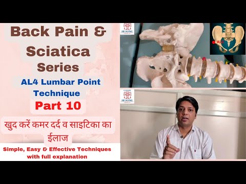 Back Pain & Sciatica। Treatment Techniques Series। Part 10 in Hindi