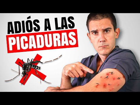 Te Revelo Cómo ERRADICAR las PICADURAS de MOSQUITO🦟 (Usa ESTO)