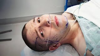 They Cut Open My Face… Here’s What Happened