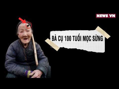 Lạ kỳ bà cụ 100 tuổi bỗng chốc mọc sừng dài cả mét sau một đêm, sừng càng cắt càng mọc dài ra