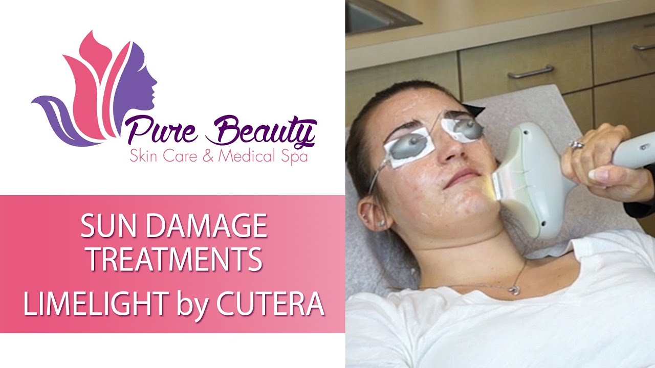 Sun damage treatment at a medical spa.