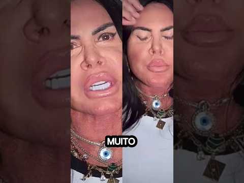 Rosto de Gretchen tá lindo
